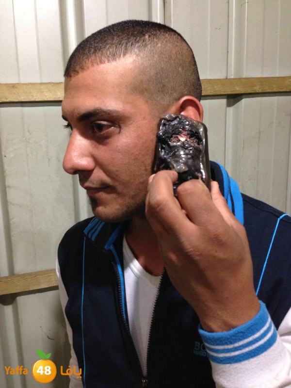 phoneludinjury (11).JPG